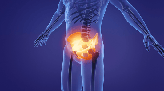 3D-Darstellung eines menschlichen Skeletts mit hervorgehobenem Beckenbereich, mögliche Darstellung von Beckenschiefstand oder Hüftproblemen.