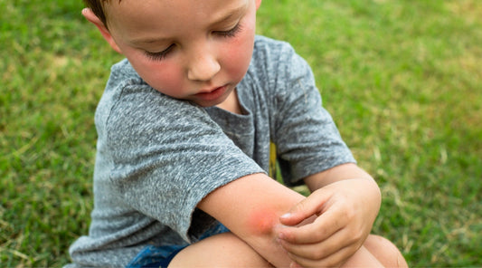Kind kratzt entzündeten Mückenstich am Arm im Freien – typische Reaktion auf Insektenstiche im Sommer